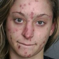 CrystalMeth